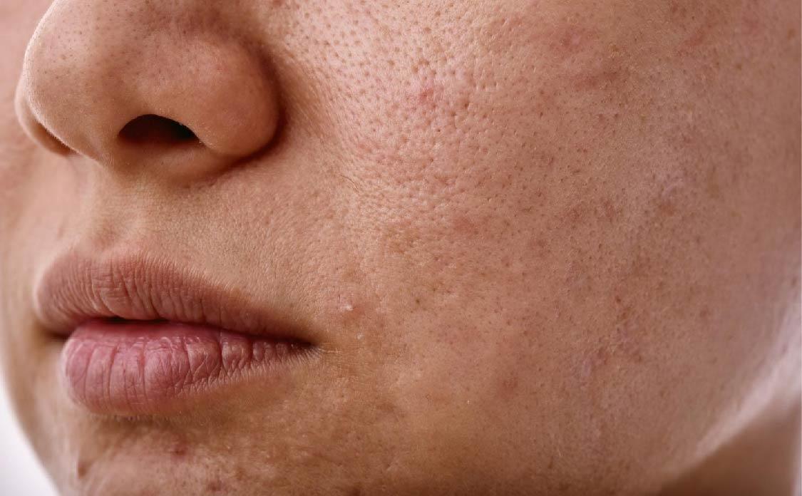 BioCare Handmade Milk and Honey Glowing Beauty Bar