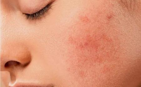 BioCare Kojic Acid Collagen Whitening Sunscreen Cream SPF 50+