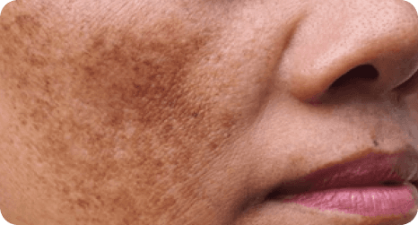 SkinClinic M Cream Night -Time