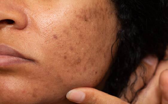 BioCare Skin Brightening Drink